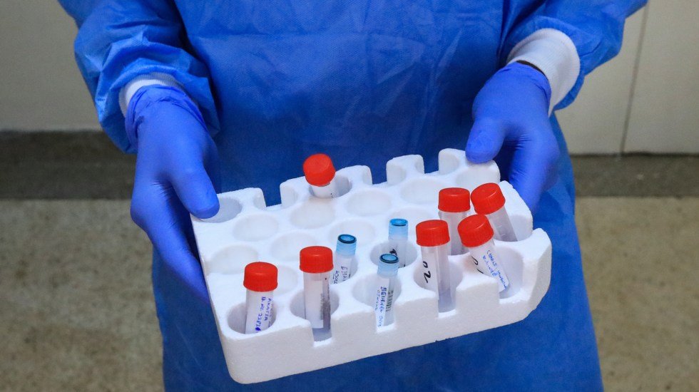 EE.UU. dice tener "pruebas enormes" del origen del coronavirus en laboratorio